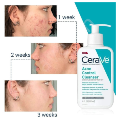 Cerave Acne Control Cleanser 473ml thumbnail 3